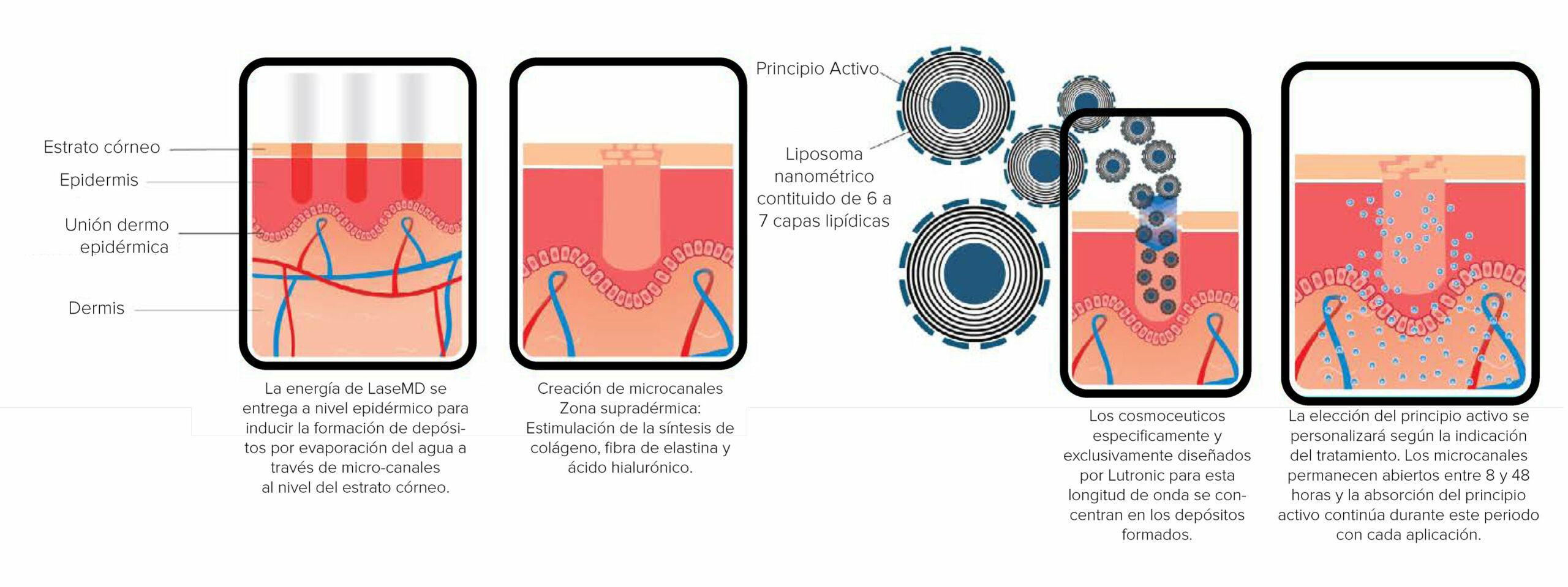 Laser fraccionado sub ablativo optimizado e inteligente scaled